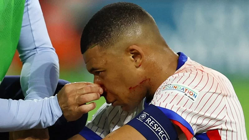 Fransa şokda: Mbappe oynamayacaq