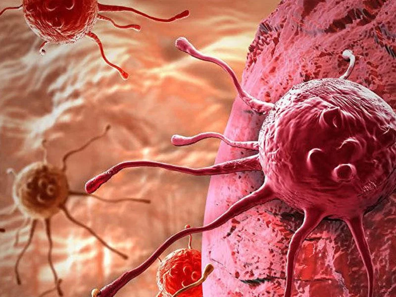 Azərbaycanlı həkimlərdən ŞOKA SALAN AÇIQLAMA: Bu ərzaqlar xərçəng yaradır!