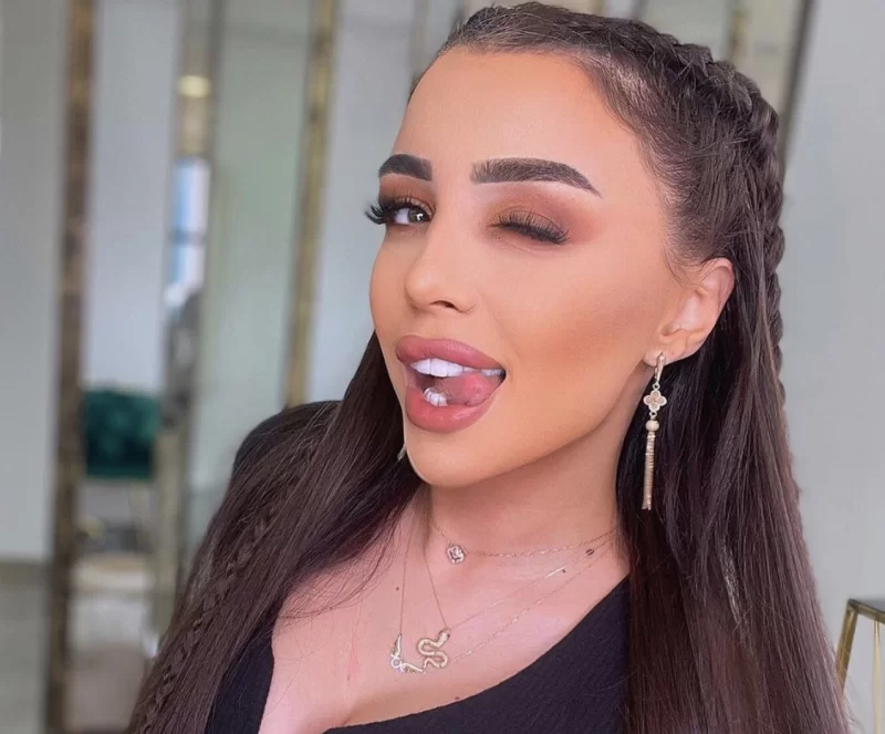 Renkanın ayaqları tutuldu, gəzə bilmir - FOTO