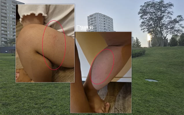 “Mərkəzi Park”da 2 yaşlı uşaq kanalizasiya quyusuna düşdü - Fotolar