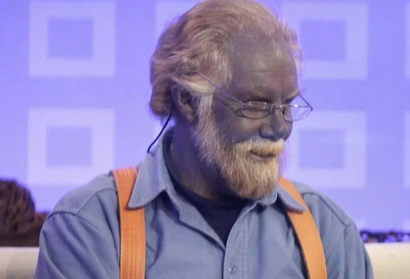 Nadir görülən “mavi dəri sindromu” haqqında yeni kəşf