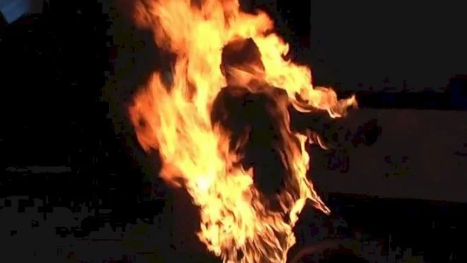 Azərbaycanda kişi yanaraq öldü